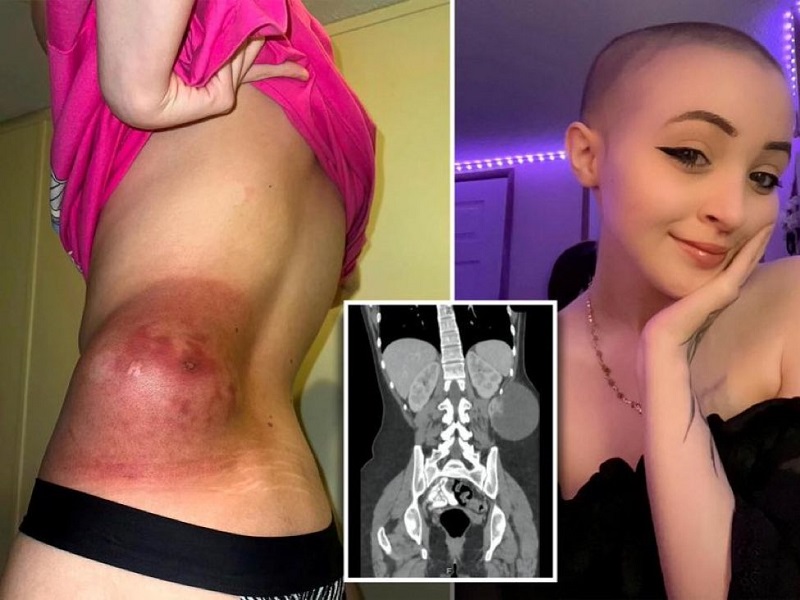 P0rnographie : Elle commet l’impensable pour guérir du cancer