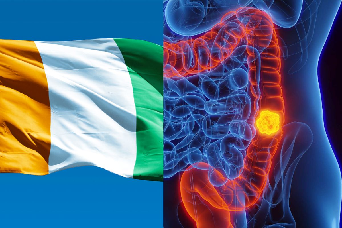 Côte d’Ivoire / Lutte contre le cancer : le pays fait d’énormes progrès