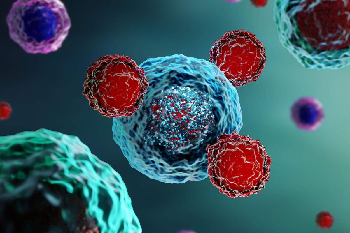 Cancer colorectal : voici pourquoi les jeunes adultes sont de plus en plus touchés ?